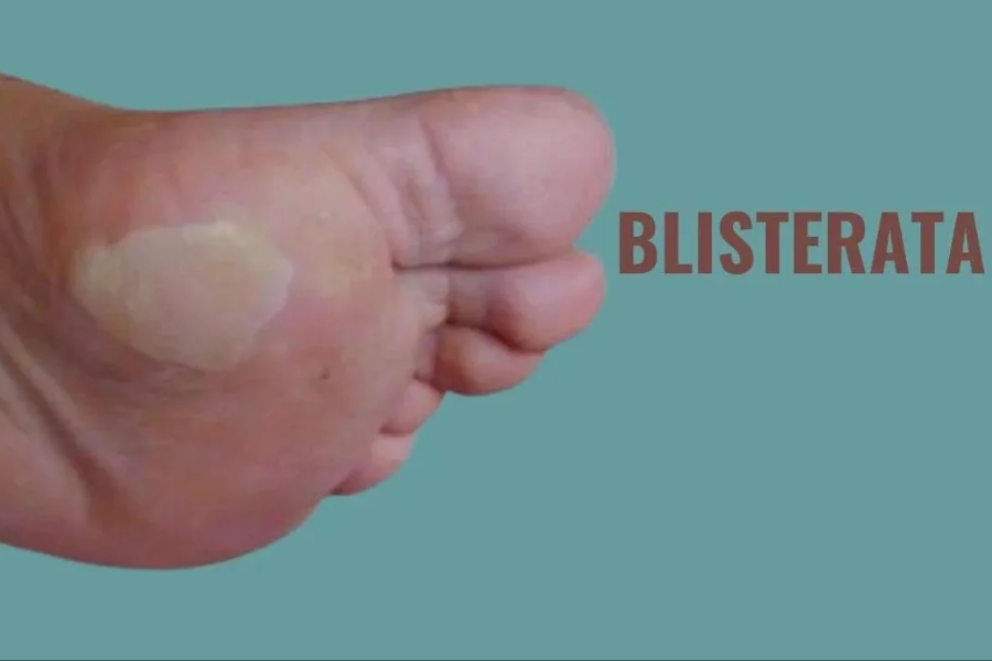 blisterata